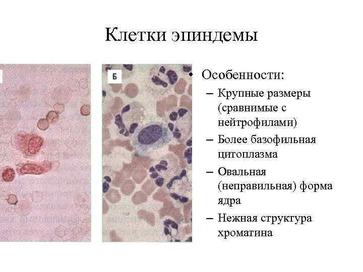 Клетки эпиндемы   • Особенности:  – Крупные размеры   (сравнимые с