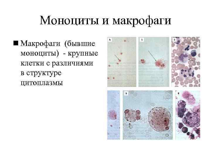  Моноциты и макрофаги n Макрофаги (бывшие  моноциты) - крупные  клетки с