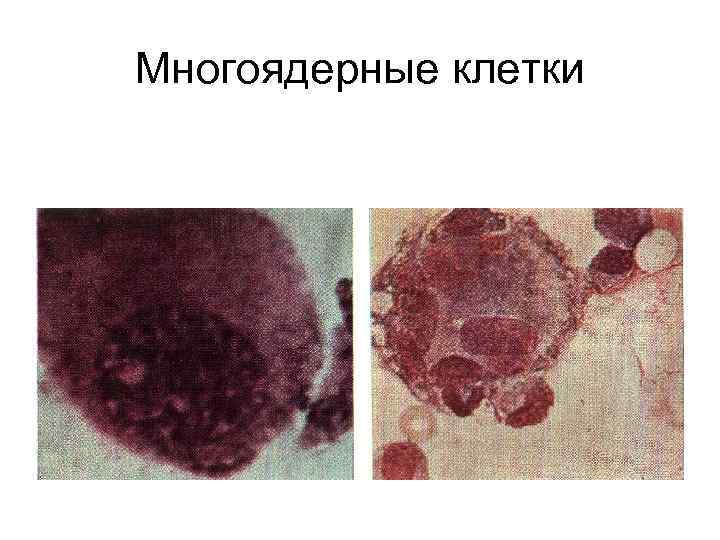 Многоядерные клетки 