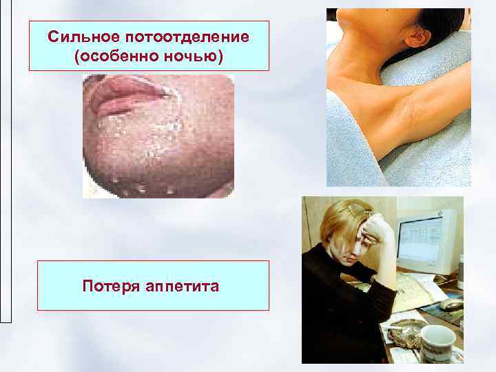 Сильное потоотделение  (особенно ночью)  Потеря аппетита 