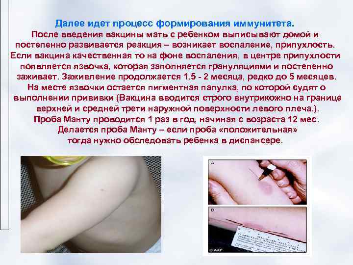    Далее идет процесс формирования иммунитета.  После введения вакцины мать с