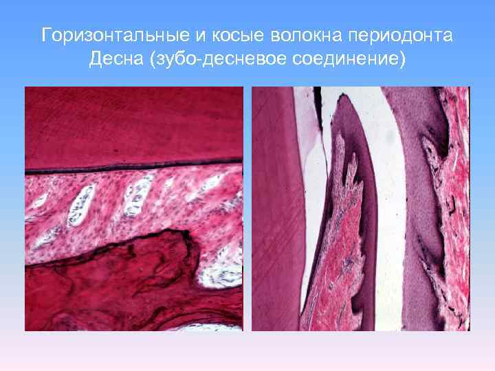 Горизонтальные и косые волокна периодонта Десна (зубо-десневое соединение) 