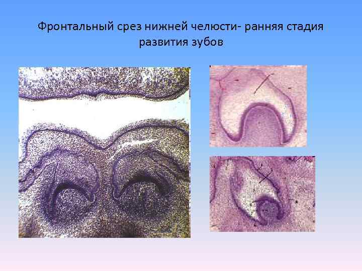 Фото нижней челюсти зубов