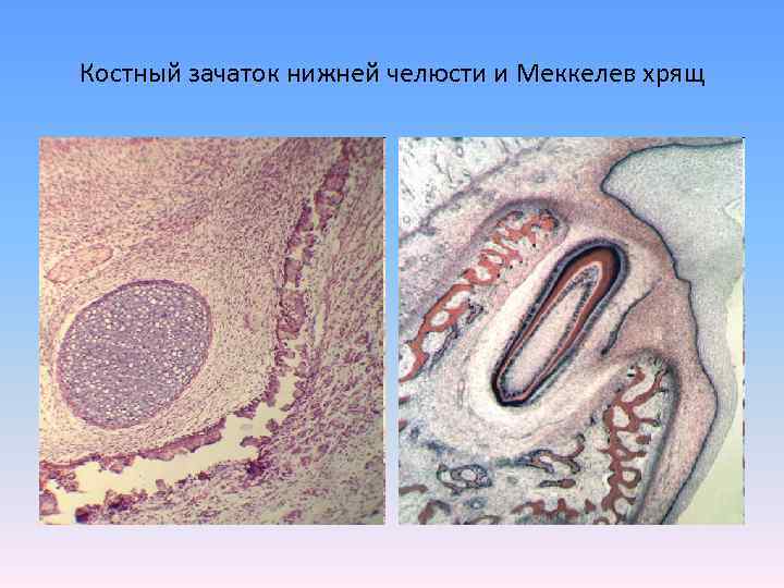 Костный зачаток нижней челюсти и Меккелев хрящ 
