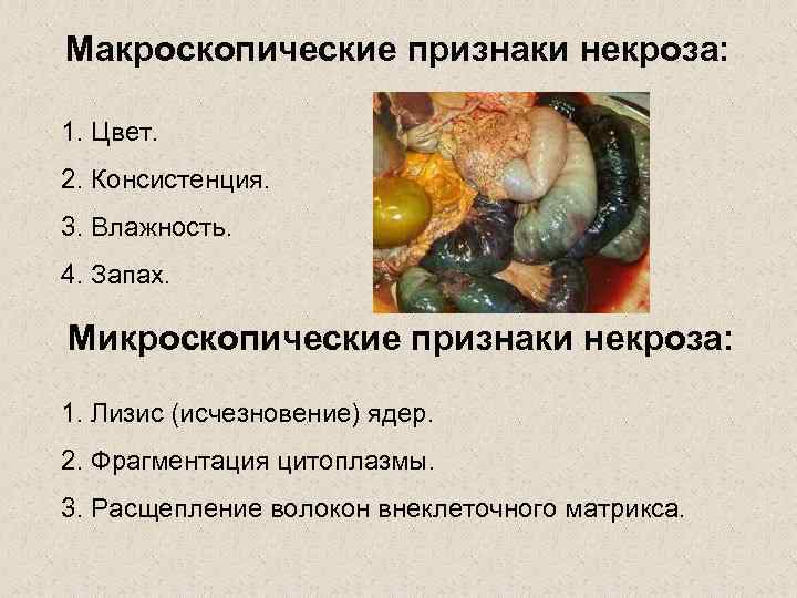 Макроскопические признаки некроза:  1. Цвет. 2. Консистенция. 3. Влажность. 4. Запах.  Микроскопические