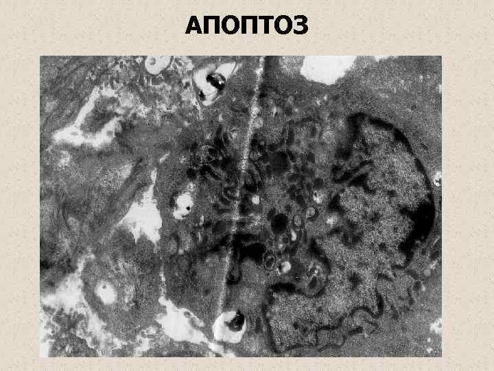 АПОПТОЗ 