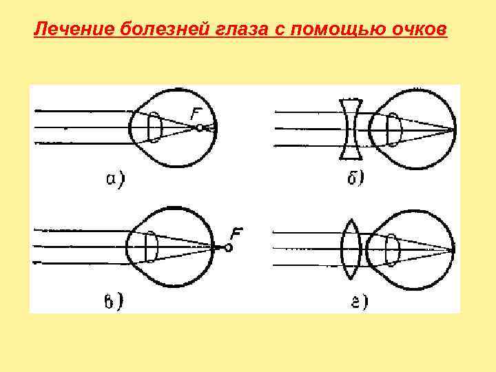 Линзы и их применение проект