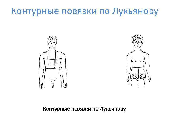 Контурные повязки по Лукьянову 