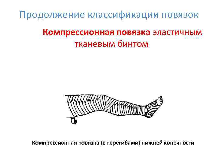 Продолжение классификации повязок Компрессионная повязка эластичным   тканевым бинтом  Компрессионная повязка (с