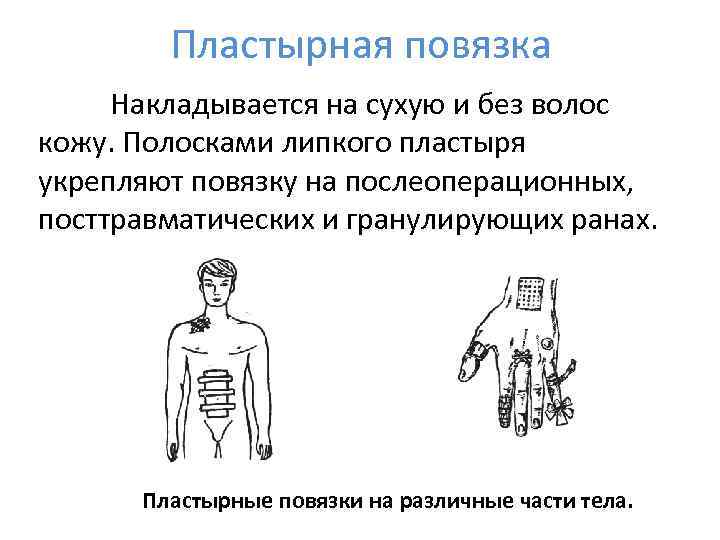   Пластырная повязка Накладывается на сухую и без волос кожу. Полосками липкого пластыря