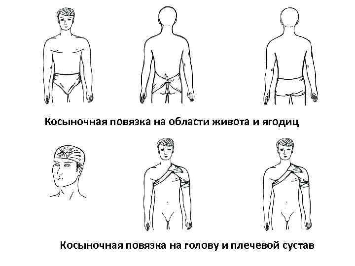 Косыночная повязка на области живота и ягодиц  Косыночная повязка на голову и плечевой