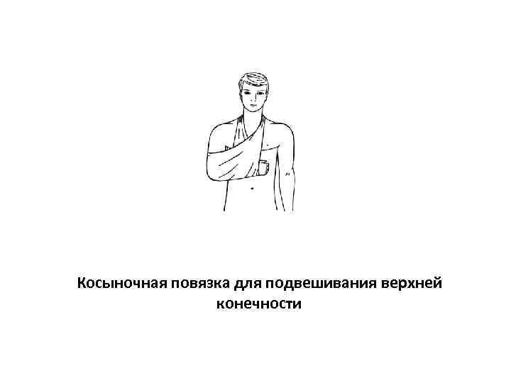 Косыночная повязка для подвешивания верхней   конечности 