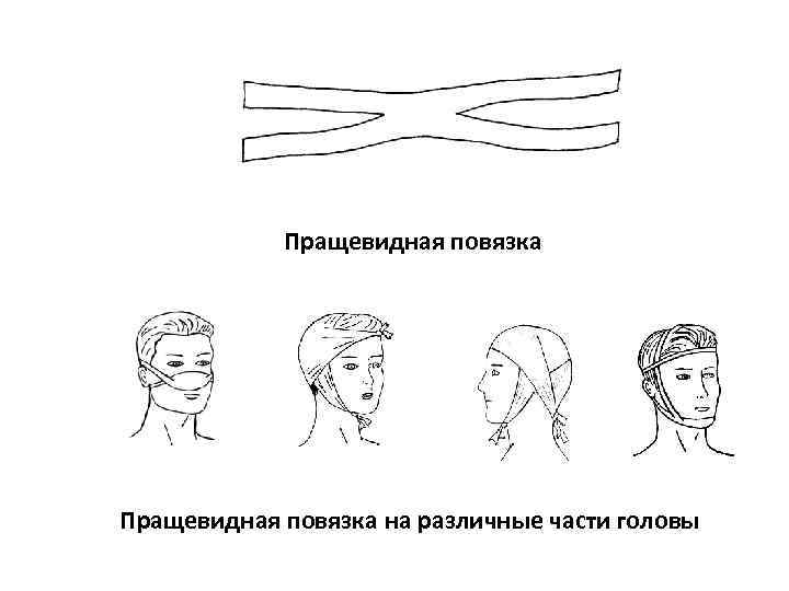 Посмотрите на рисунок 1 и подпишите типы бинтовых повязок