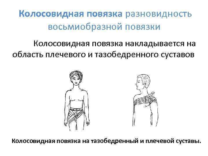  Колосовидная повязка разновидность  восьмиобразной повязки Колосовидная повязка накладывается на область плечевого и