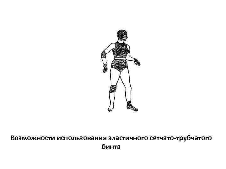 Возможности использования эластичного сетчато-трубчатого     бинта 