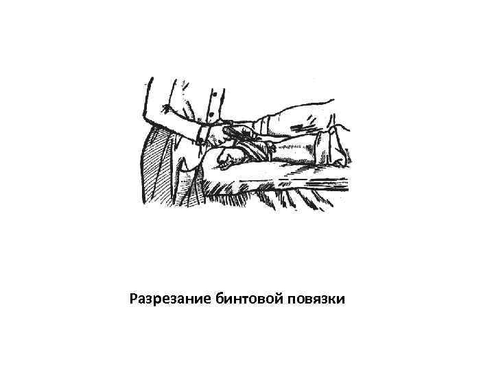 Разрезание бинтовой повязки 