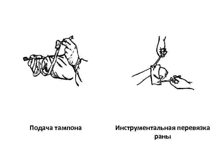 Перевязка в ране и на протяжении