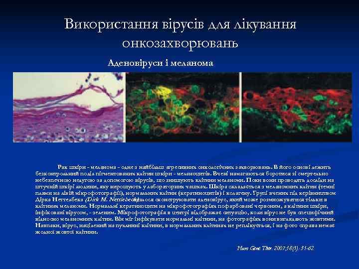    Використання вірусів для лікування   онкозахворювань    