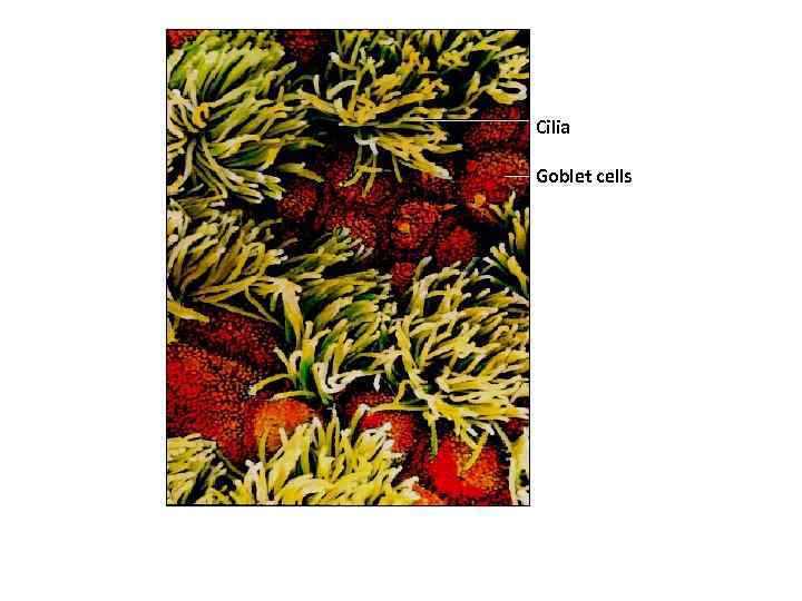 Cilia Goblet cells 