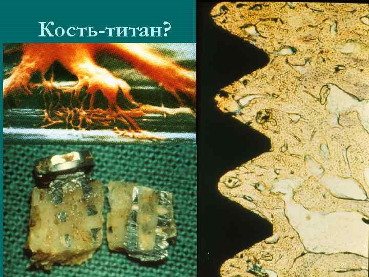 Кость-титан?     21 