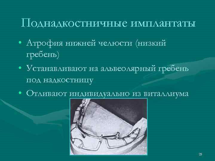 Поднадкостничные имплантаты • Атрофия нижней челюсти (низкий  гребень) • Устанавливают на альвеолярный гребень