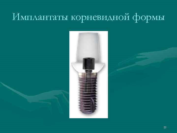 Имплантаты корневидной формы      27 