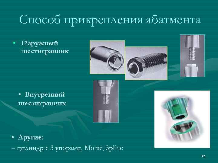  Способ прикрепления абатмента • Наружный  шестигранник  • Внутренний  шестигранник •