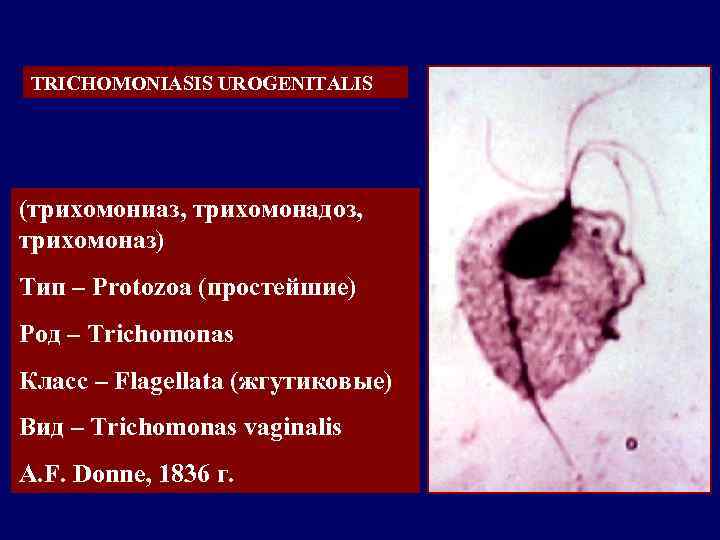 Trichomonas vaginalis пцр