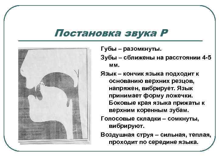 Постановка звука Р  Губы – разомкнуты.   Зубы – сближены на расстоянии