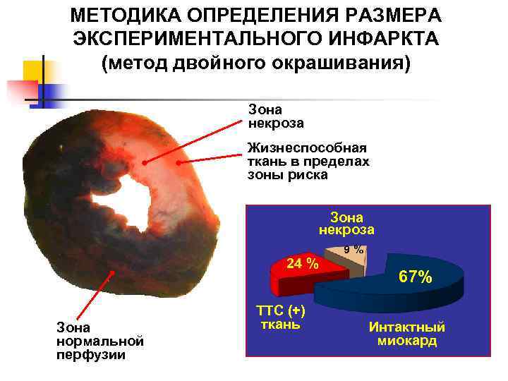  МЕТОДИКА ОПРЕДЕЛЕНИЯ РАЗМЕРА ЭКСПЕРИМЕНТАЛЬНОГО ИНФАРКТА  (метод двойного окрашивания)   Зона 