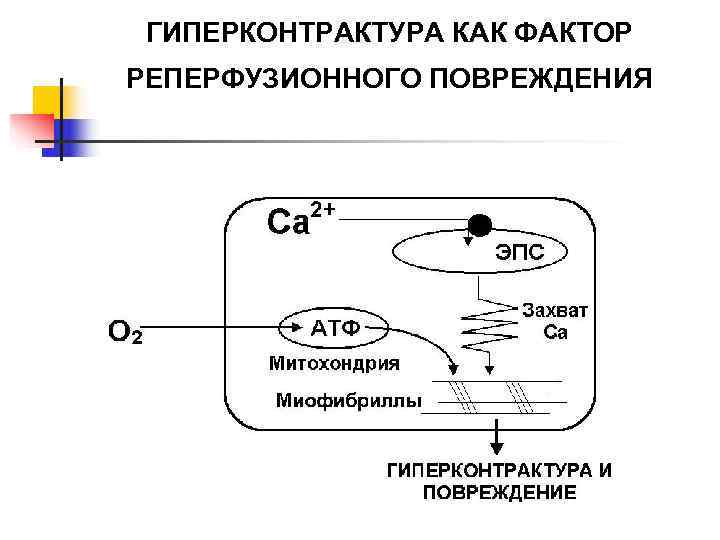  ГИПЕРКОНТРАКТУРА КАК ФАКТОР РЕПЕРФУЗИОННОГО ПОВРЕЖДЕНИЯ 
