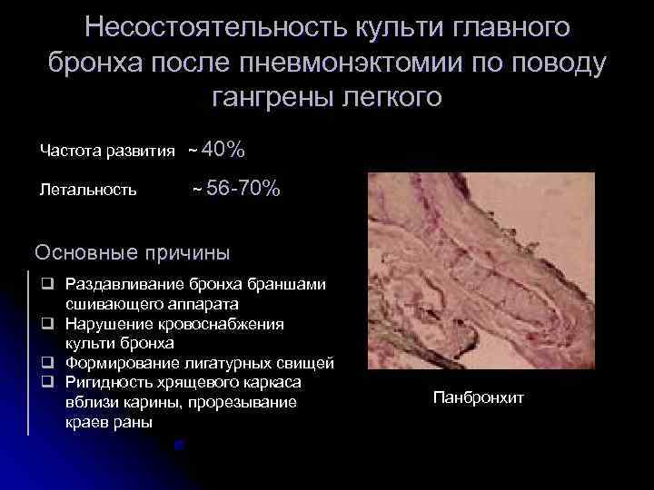   Несостоятельность культи главного бронха после пневмонэктомии по поводу   гангрены легкого