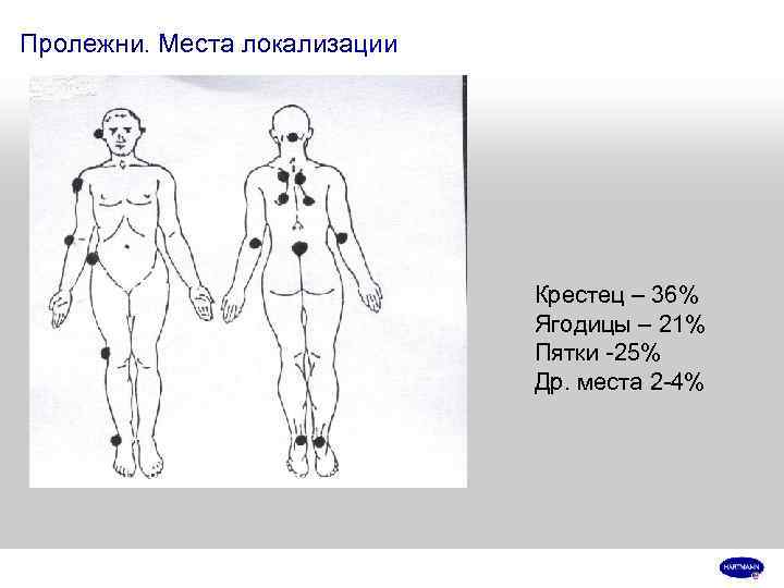 Пролежни. Места локализации      Крестец – 36%   
