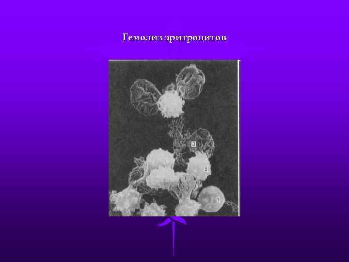 Гемолиз лейкоцитов. Лизис эритроцитов. Гемолиз. Гемолиз это в медицине.