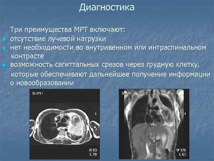      Диагностика Три преимущества МРТ включают: n  отсутствие лучевой