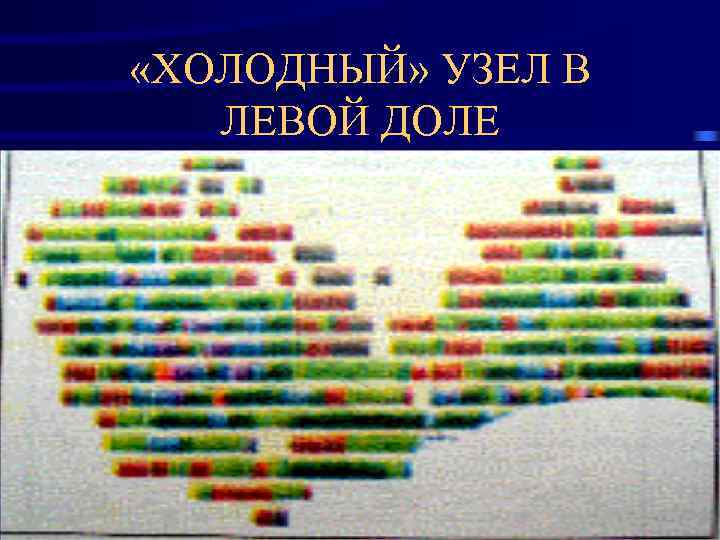  «ХОЛОДНЫЙ» УЗЕЛ В  ЛЕВОЙ ДОЛЕ 