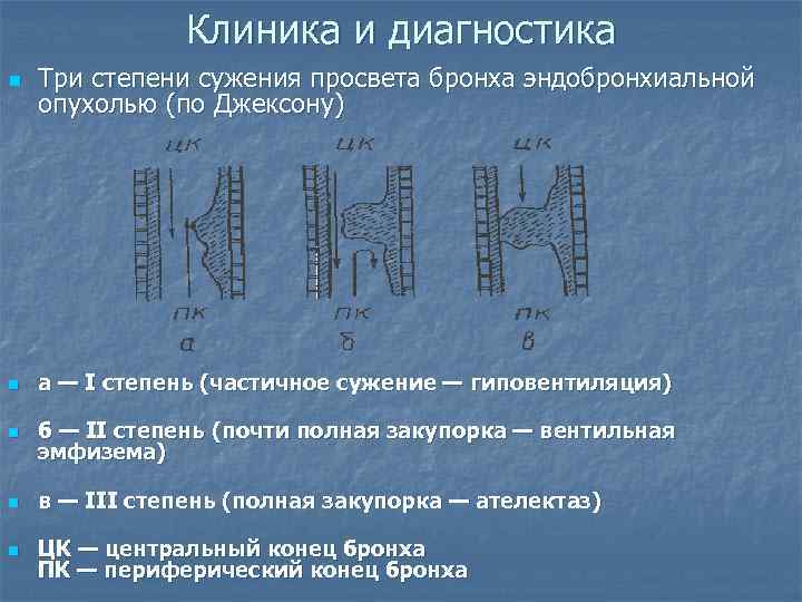     Клиника и диагностика n  Три степени сужения просвета бронха