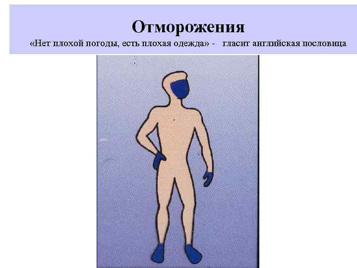      Отморожения «Нет плохой погоды, есть плохая одежда» - гласит