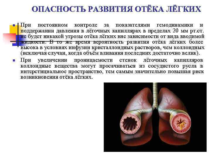   ОПАСНОСТЬ РАЗВИТИЯ ОТЁКА ЛЁГКИХ n  При постоянном контроле за показателями гемодинамики