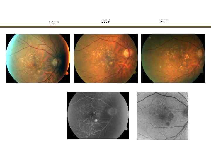 2007  2009  2013 