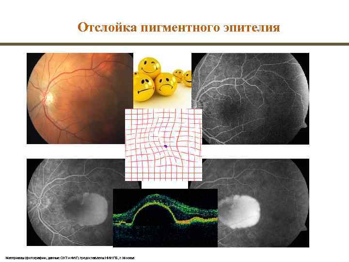        Поздние изменения     