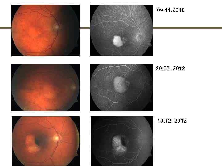 09. 11. 2010 30. 05. 2012 13. 12. 2012 