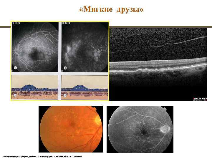        «Мягкие друзы»     