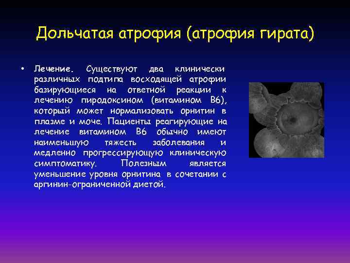   Дольчатая атрофия (атрофия гирата)  •  Лечение. Существуют два клинически различных