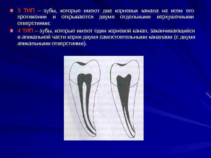 3 ТИП – зубы, которые имеют два корневых канала на всем его протяжении и