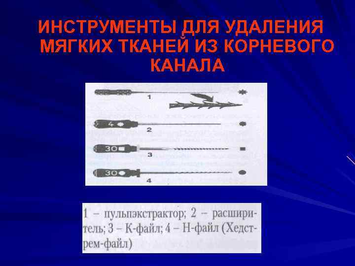 ИНСТРУМЕНТЫ ДЛЯ УДАЛЕНИЯ МЯГКИХ ТКАНЕЙ ИЗ КОРНЕВОГО  КАНАЛА 