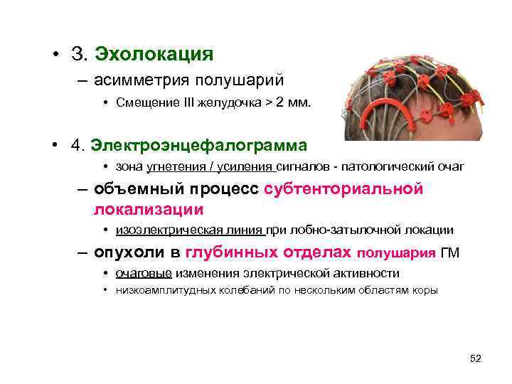  • З. Эхолокация  – асимметрия полушарий  • Смещение III желудочка >