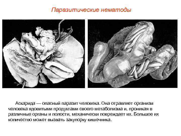    Паразитические нематоды  Аскарида — опасный паразит человека. Она отравляет организм