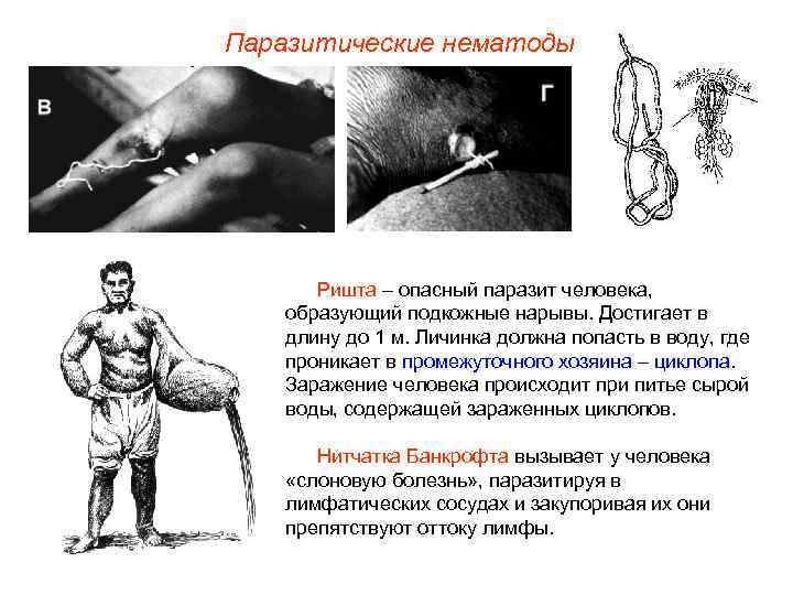 Паразитические нематоды  Ришта – опасный паразит человека, образующий подкожные нарывы. Достигает в длину
