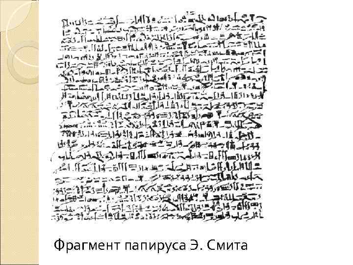 Фрагмент папируса Э. Смита 